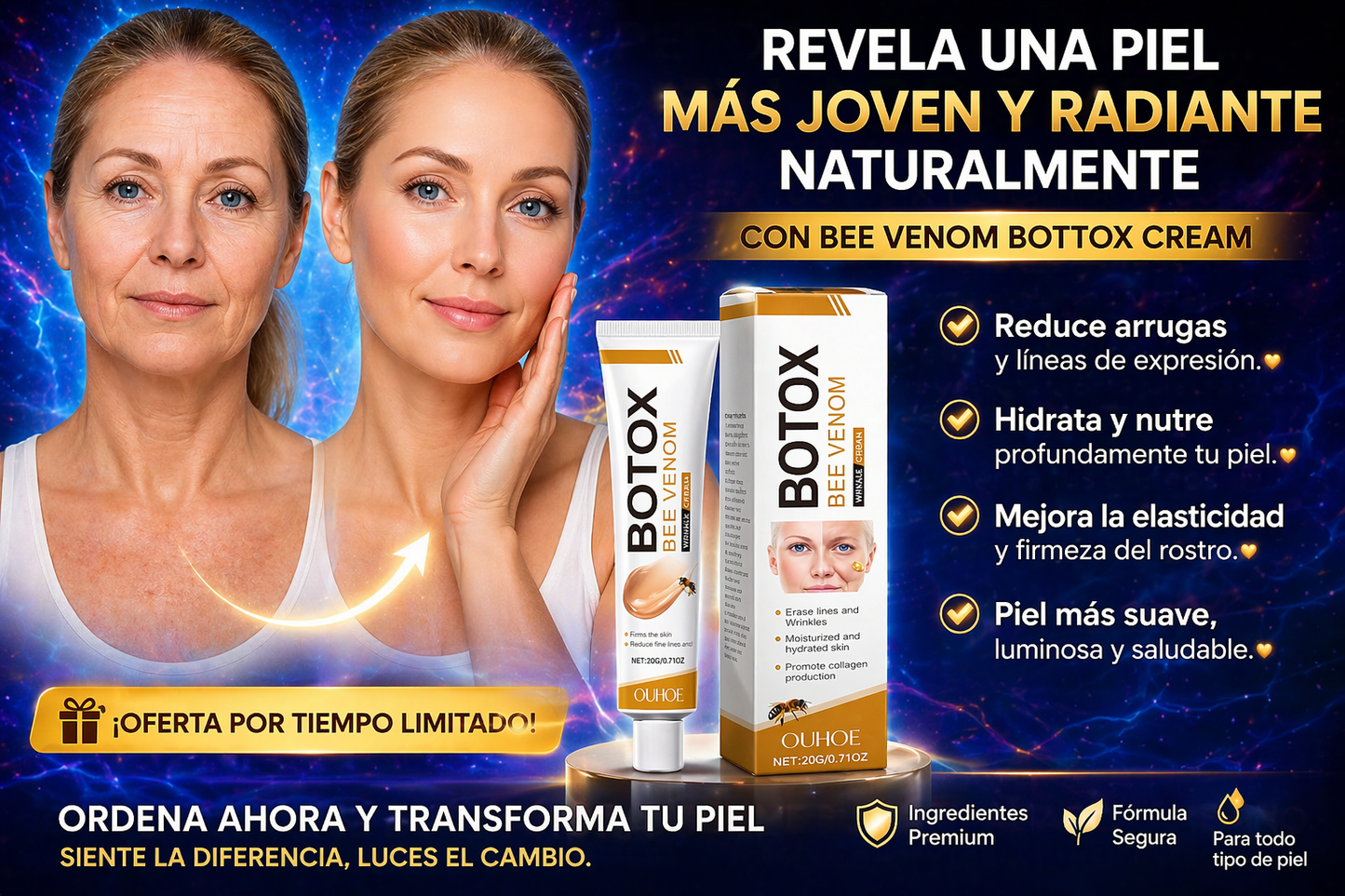CREMA DE BOTOX VENENO DE ABEJA